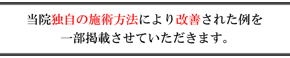 症状別ビフォーアフター